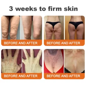 ✨FDA Approved: ODALIT® Bee venom Pro Comprehensive Cream — 🔥Limited Time 80% OFF🔥