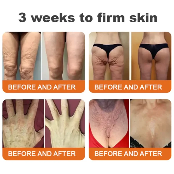 ✨FDA Approved: ODALIT® Bee venom Pro Comprehensive Cream — 🔥Limited Time 80% OFF🔥