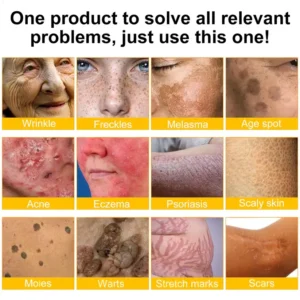 ✨FDA Approved: ODALIT® Bee venom Pro Comprehensive Cream — 🔥Limited Time 80% OFF🔥