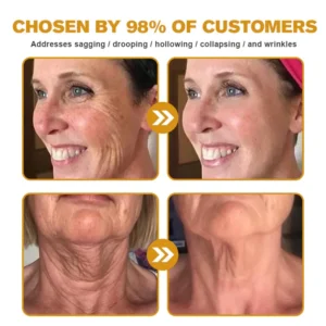 ✨FDA Approved: ODALIT® Bee venom Pro Comprehensive Cream — 🔥Limited Time 80% OFF🔥