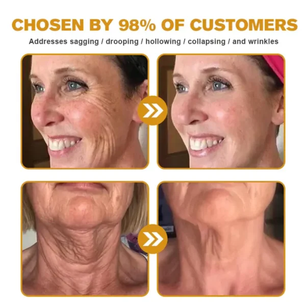 ✨FDA Approved: ODALIT® Bee venom Pro Comprehensive Cream — 🔥Limited Time 80% OFF🔥