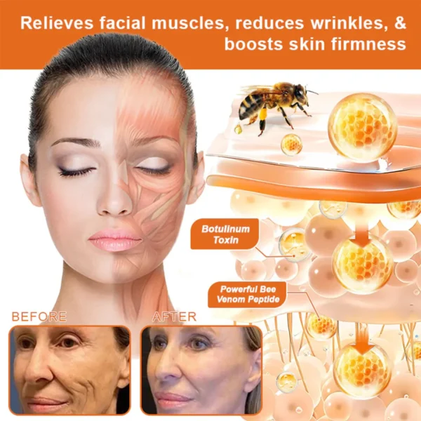 ✨FDA Approved: ODALIT® Bee venom Pro Comprehensive Cream — 🔥Limited Time 80% OFF🔥