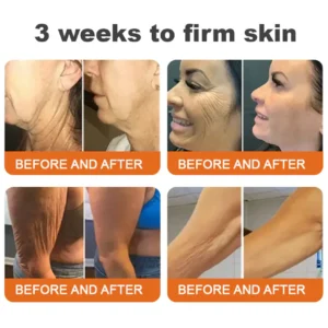 ✨FDA Approved: ODALIT® Bee venom Pro Comprehensive Cream — 🔥Limited Time 80% OFF🔥