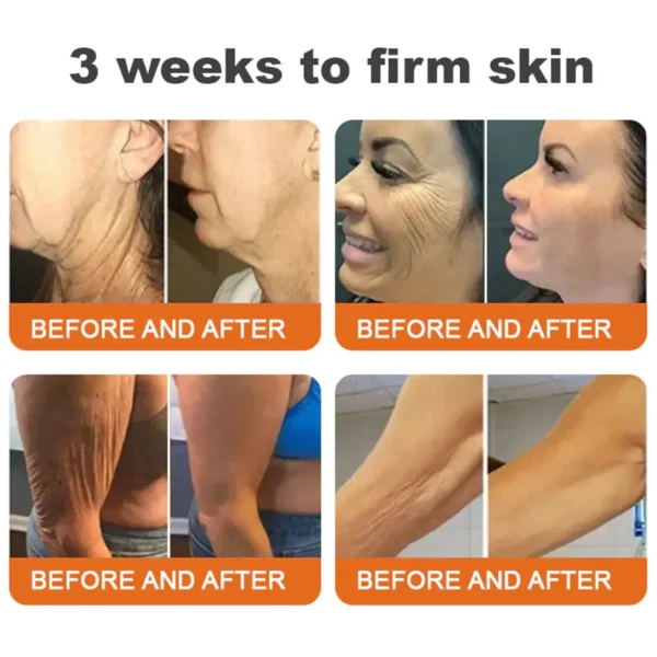 ✨FDA Approved: ODALIT® Bee venom Pro Comprehensive Cream — 🔥Limited Time 80% OFF🔥
