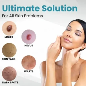 ODALIT™ Non-Invasive Mole and Wart Removal Laser Pen