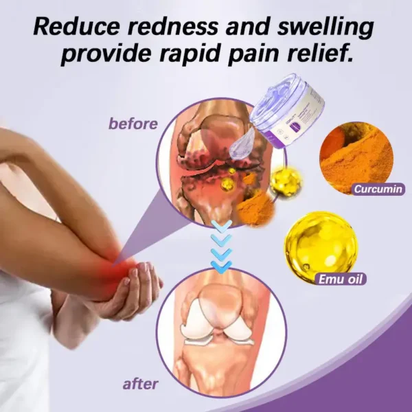 ✅Official Store: ODALIT™ Turmeric & Emu Oil Arthritis Soothing Pain Relief Massage Gel 👨‍⚕️Australian Osteopathic Association （AOA）Approved