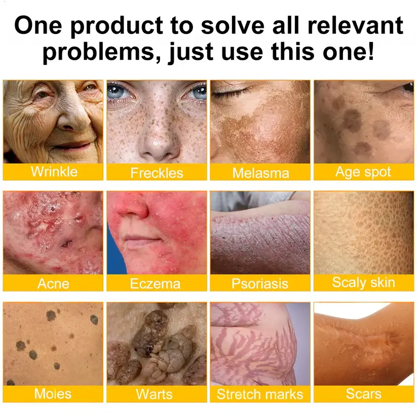FDA Approved: ODALIT® Bee Venom Skin Restoration Cream — 🔥Limited Time 70% OFF🔥