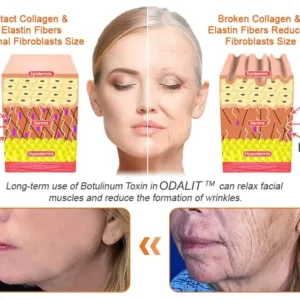FDA Approved: ODALIT® Bee Venom Skin Restoration Cream — 🔥Limited Time 70% OFF🔥
