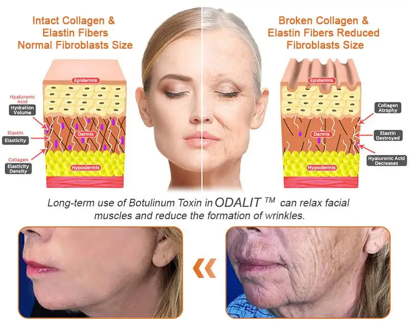 FDA Approved: ODALIT® Bee Venom Skin Restoration Cream — 🔥Limited Time 70% OFF🔥
