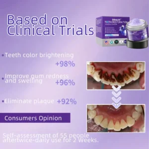 🎁Flash Sale - Don’t Miss Out - ODALIT™ TeethRestoration Mineral Powder🦷(ADA recommended)👩⚕️(Treats periodontitis and mouth ulcers, prevents tooth loss, and repairs gum recession)