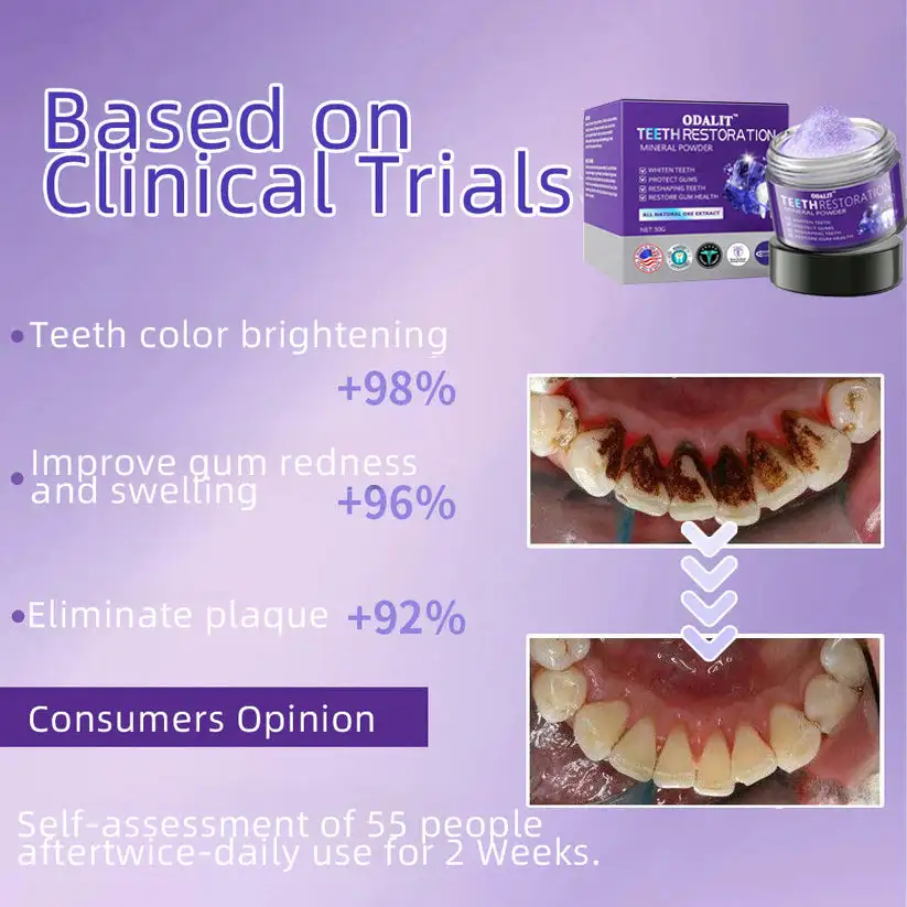 🎁Flash Sale - Don’t Miss Out - ODALIT™ TeethRestoration Mineral Powder🦷(ADA recommended)👩⚕️(Treats periodontitis and mouth ulcers, prevents tooth loss, and repairs gum recession)