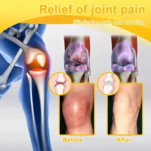 🎁Flash Sale - ODALIT™ Botulinum Toxin & Bee Venom Pain-Relief Bone Healing Cream🐝💎